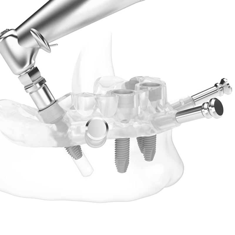 Implant Surgical Guides 3D Dental Milling Dental Technology
